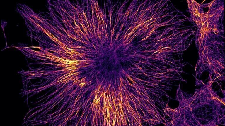 Confocal Microscopy: Getting the Most from Working Systems